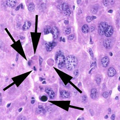 Cellules de foie de souris mourant par apoptose (marquées par des flèches). Ce suicide cellulaire est normal chez l'individu